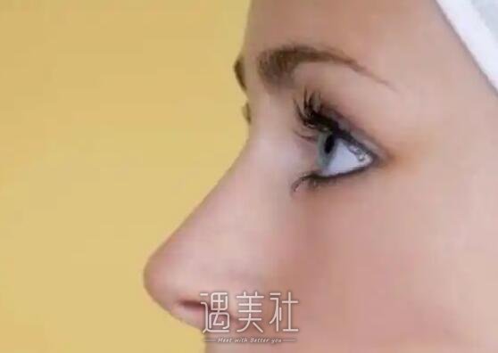 北京宫风勇医生做鼻子好吗？2022招牌案例公布 width=