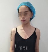 沈阳美莱高国林3万多隆胸，隆胸术后1100天对比图 width=