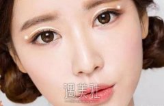 什么是双眼皮手术？做双眼皮得需要多少钱？ width=
