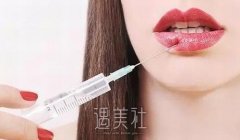 丰唇手术一般多少钱？可以通过注射丰唇吗？ width=