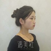 郭学永医生眼修复案例，重现明眸亮眼的魅力 width=