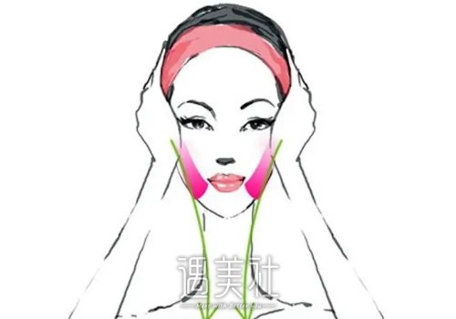 悬吊筋膜拉皮手术多少钱？效果能保持多久？ width=