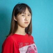 肿眼皮割双眼皮图片，恢复过程图公开，一眼倾城 width=