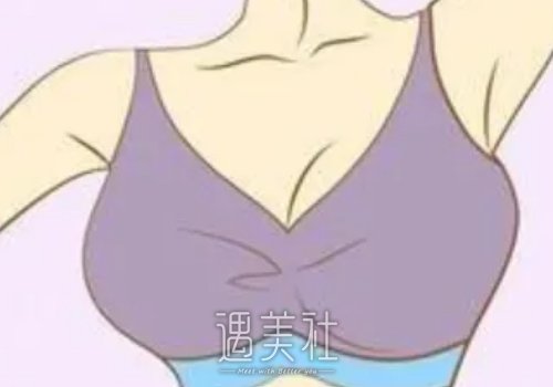 傲诺拉和曼托哪种好？两者有什么区别？ width=