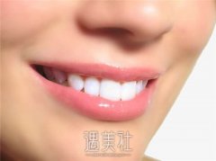 全口假牙价格6000左右算好吗？具体费用取决于所选择的假牙材料 width=
