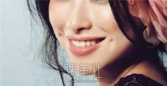 眼部整形的价格是多少？不同地区有所差异 width=