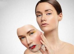 颧骨是哪里图片，颧骨太高怎么办？颧骨整形前后对比图展示 width=