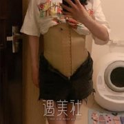 吸脂手术全过程图片，腰腹部抽脂恢复效果图 width=