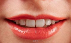 烤瓷牙得多少钱？价格收费与很多因素有关系 width=