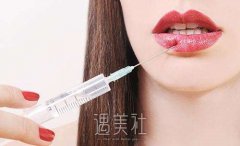 新玻尿酸丰唇价格，超值优惠快来了解！ width=