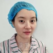 黄名斗双眼皮失败修复案例，从不想见人，到随处炫耀 width=