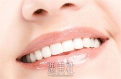 牙齿矫正何时进行佳？适合年龄是多少？ width=