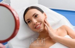 去颊脂垫老了之后照片，去颊脂垫会老得快吗？ width=