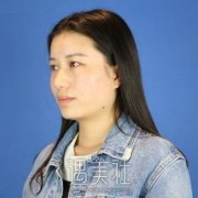 闫宏山双眼皮整形失败修复案例，重新绽放美丽 width=