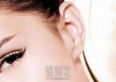 汪景博士小耳畸形整形技术怎么样？在哪里坐诊？真人案例鉴赏 width=