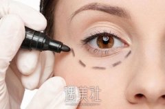 长沙湘雅袪眼袋技术怎么样？医生简介+全新价目表更新 width=