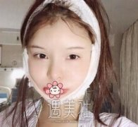 籍建华下颌角失败修复案例，技术在线，让我重获美丽 width=