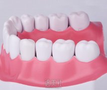 上海牙齿超薄瓷贴面价位发布，2024年的新价位表有何惊喜？ width=