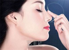 广州隆鼻失败修复价目表分享！专业修复仅需5000元起 width=
