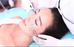 潍坊玻尿酸丰臀医美医院排行榜推荐，专业丰臀效果佳 width=