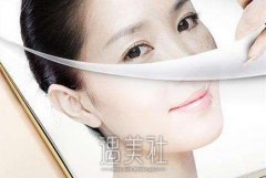 广州隆鼻假体取出价格表公布，歪鼻修复特惠价8000元起